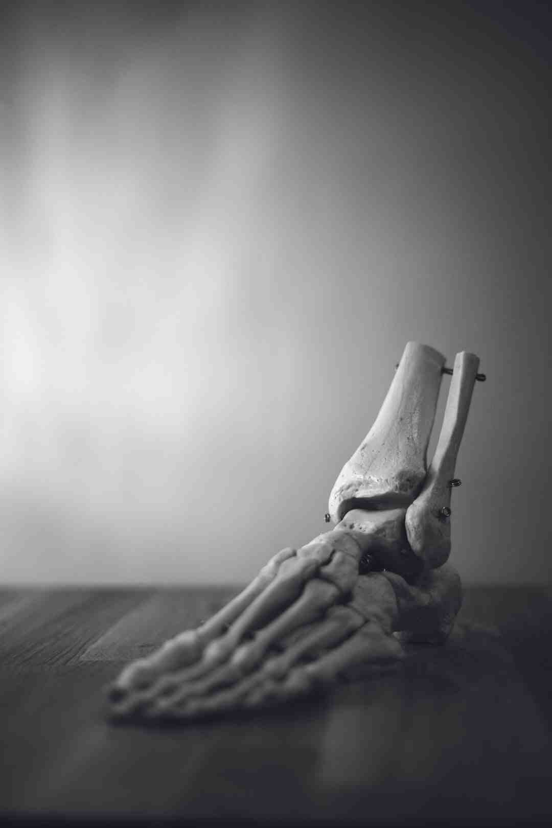 C'est quoi se fouler la cheville ?