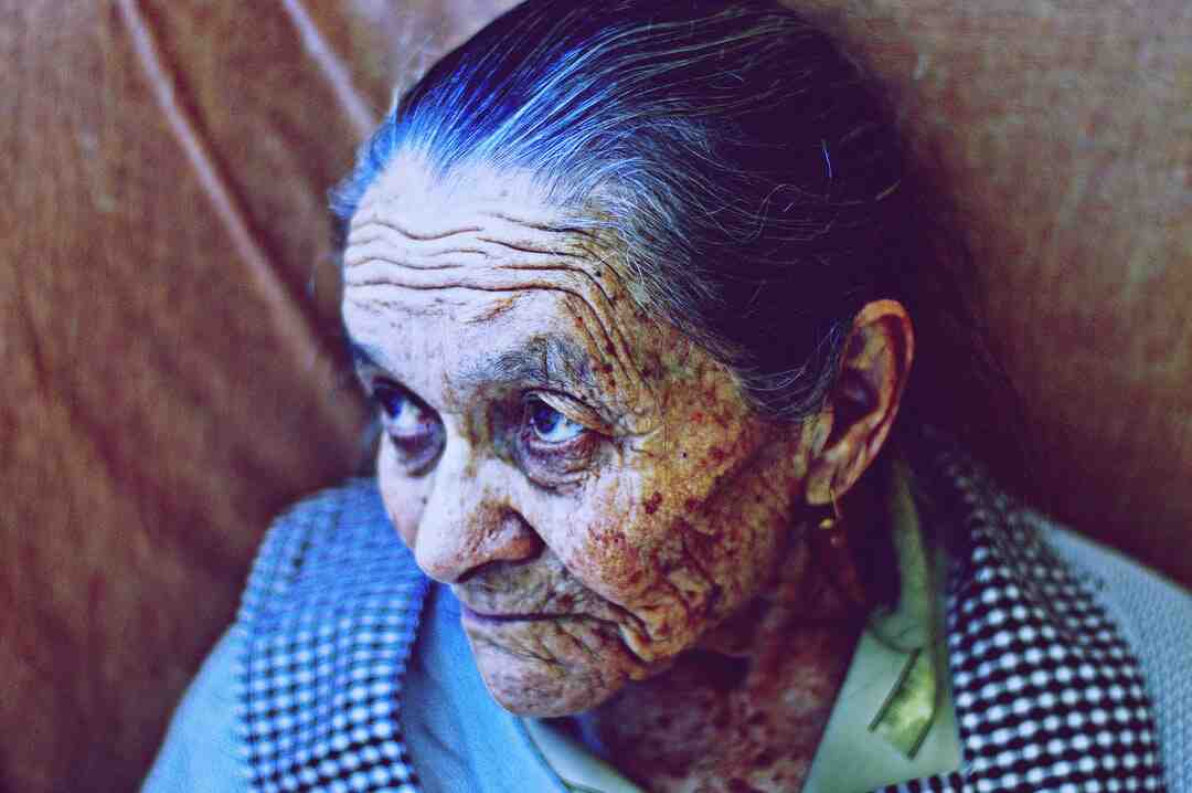 Comment soigner un ongle en forme de tuile ?