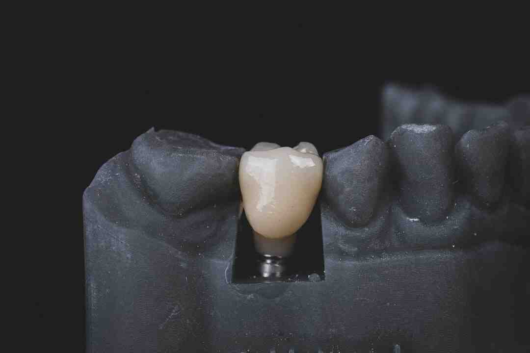 Comment avoir les dents blanches avec du miel ?