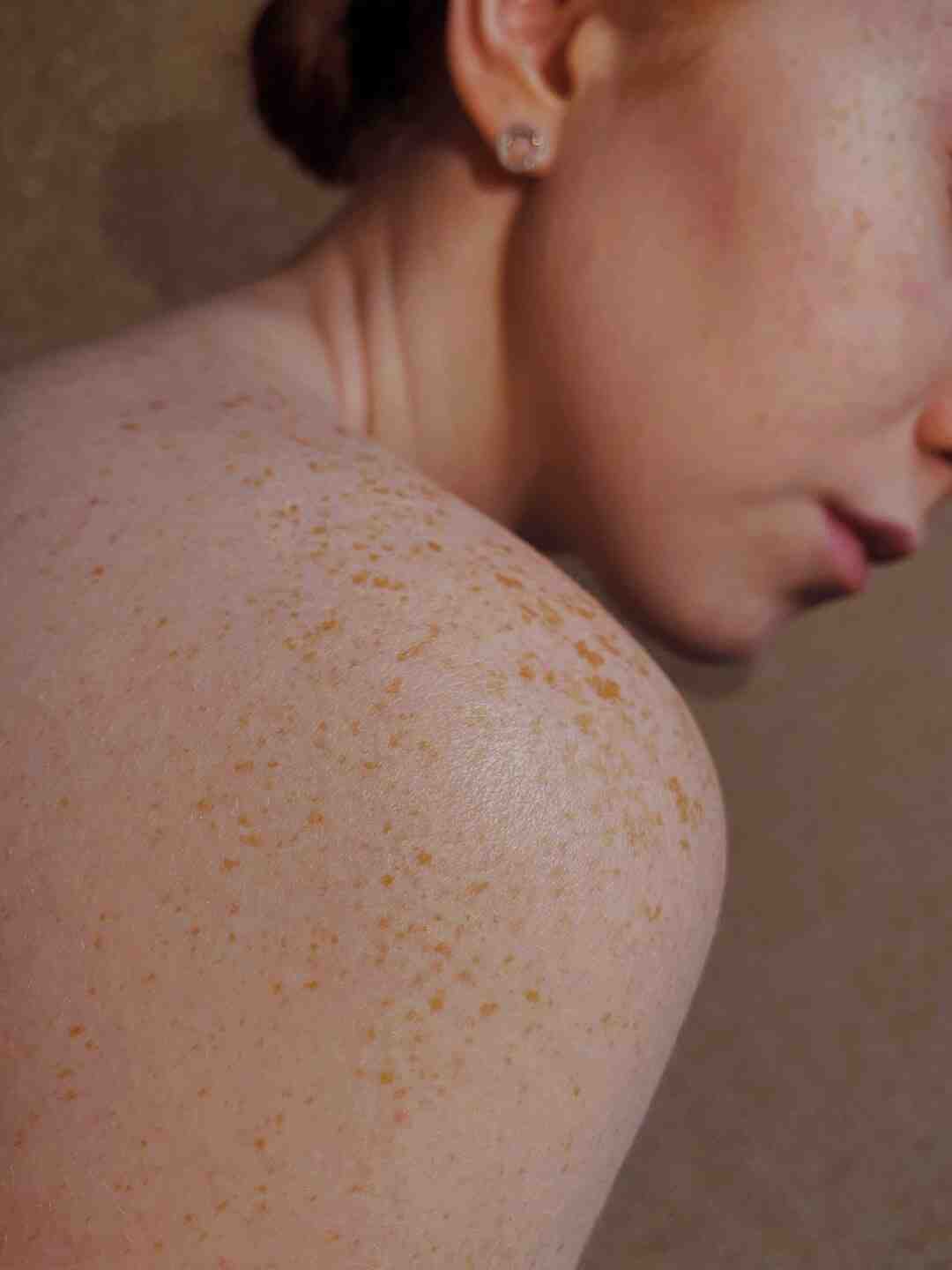 Comment avoir une peau parfaite en 1 semaine ?