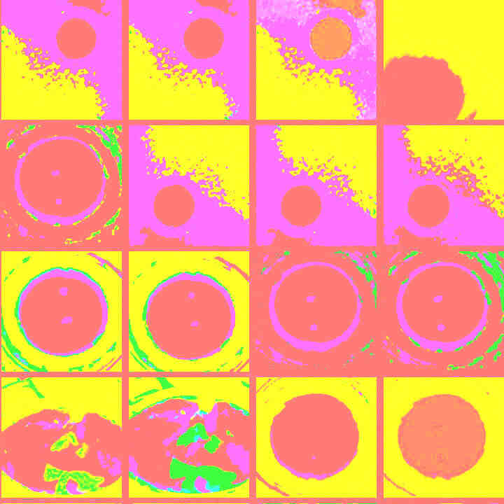 Comment soigner un bobo sur la lèvre ?