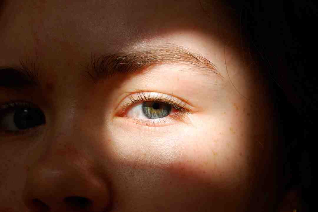 Pourquoi ma peau n'est pas lisse ?